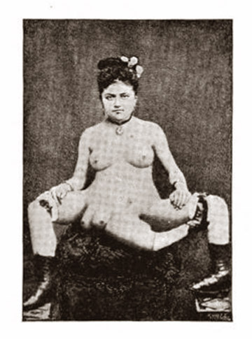 AHS pernas